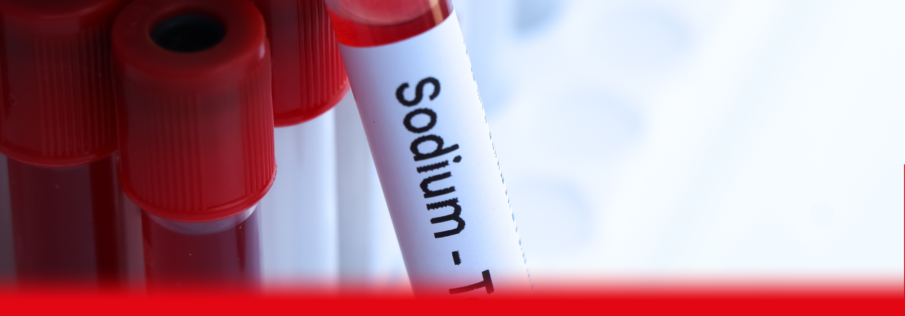 sodium blood test sample
