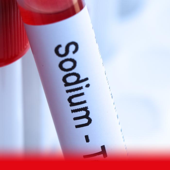 sodium blood test sample