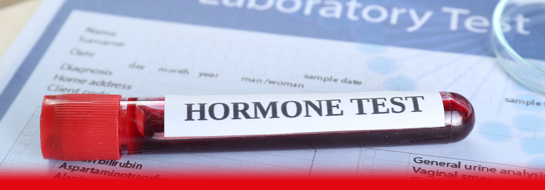 HOW LONG DOES A HORMONE BLOOD TEST TAKE?