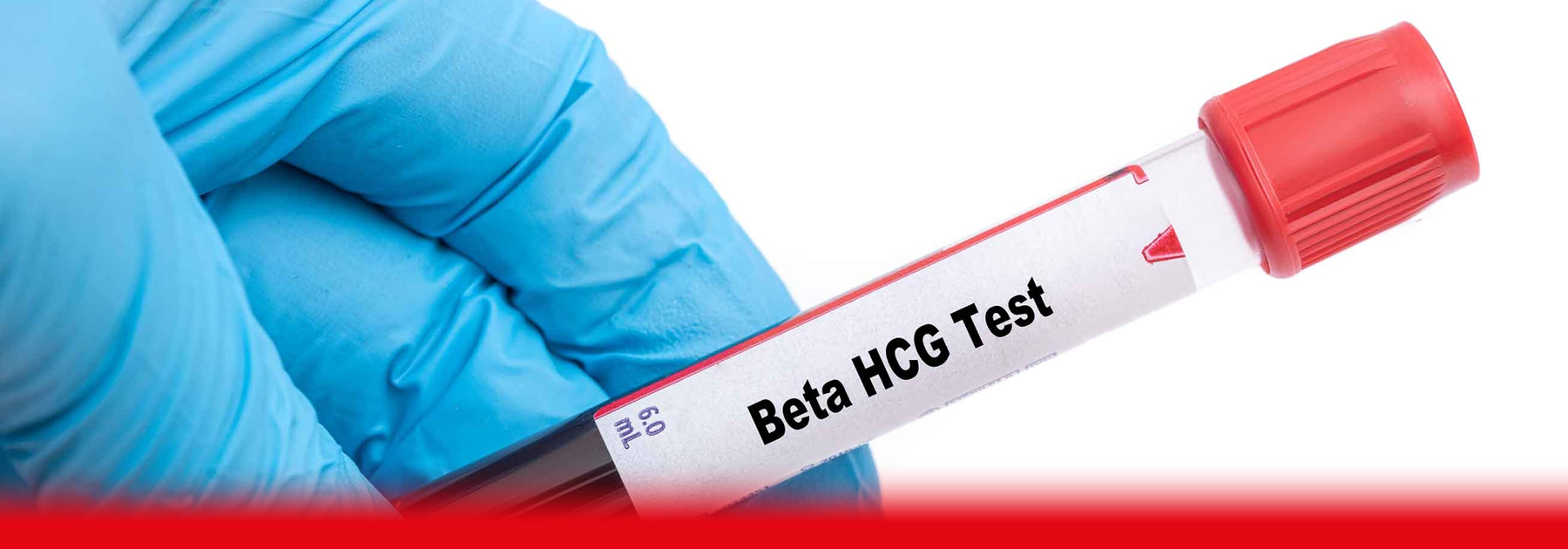 doctor holding hcg blood test sample