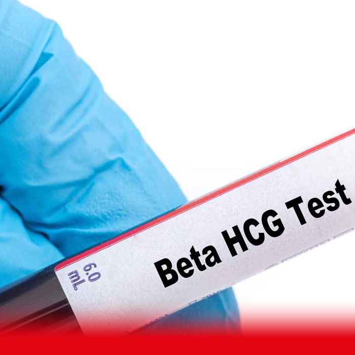 doctor holding hcg blood test sample