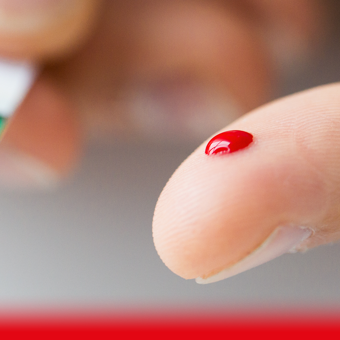 WHAT IS A NORMAL INSULIN LEVEL IN THE BLOOD?