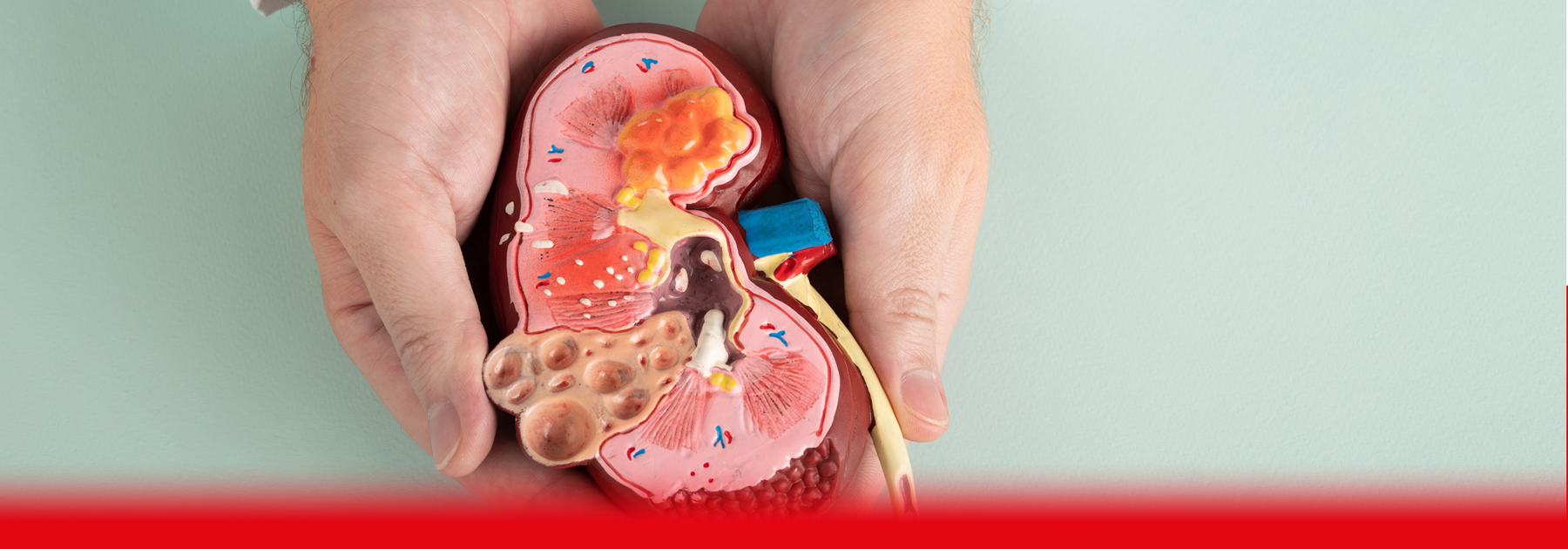 kidney model