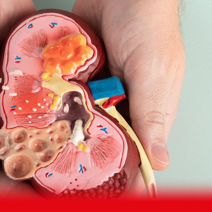 kidney model
