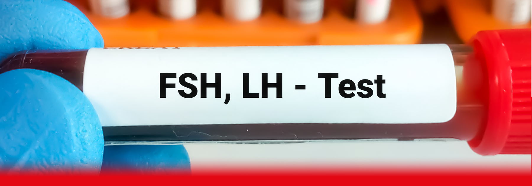 doctor holding up menopause test sample