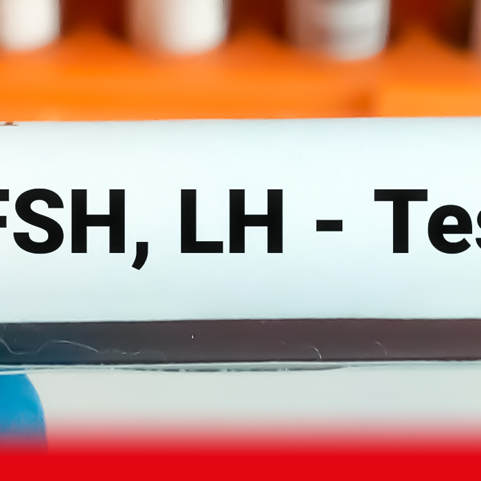 doctor holding up menopause test sample