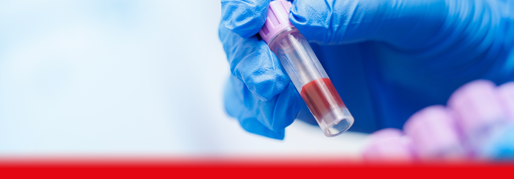 doctor holding blood sample