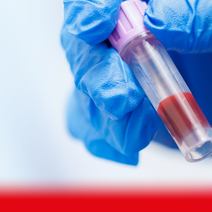 doctor holding blood sample