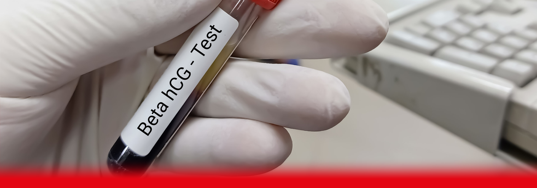 doctor holding hcg test sample