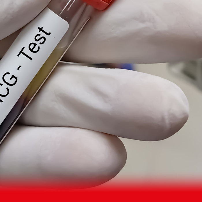 doctor holding hcg test sample