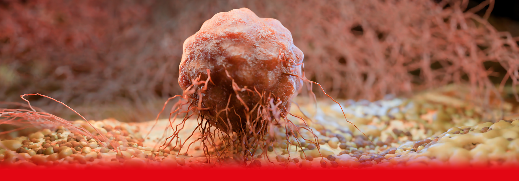 tumour up close