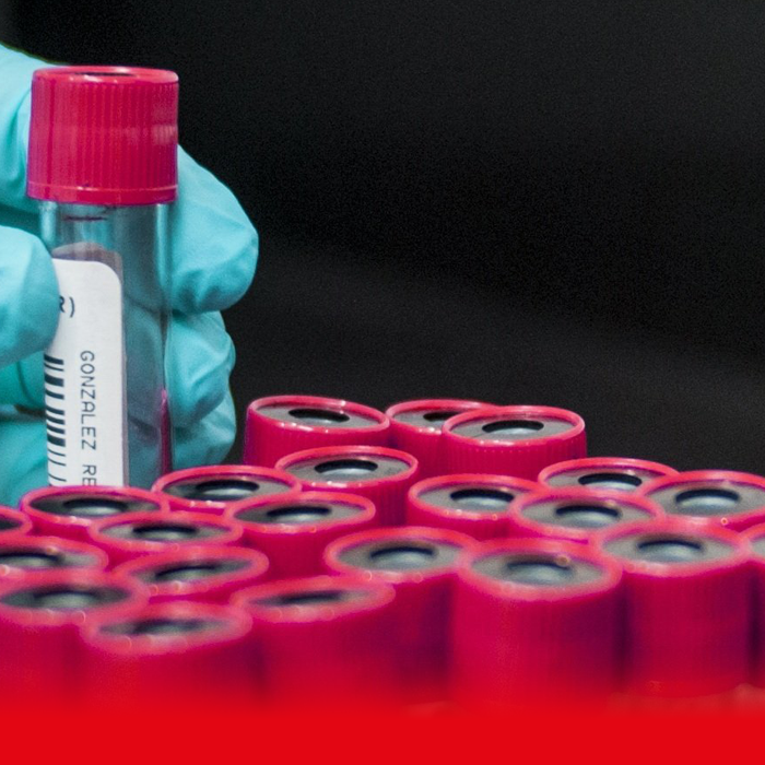doctor holding blood sample