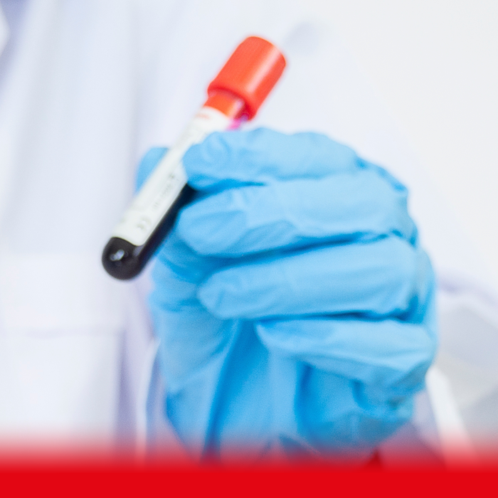 doctor holding blood sample