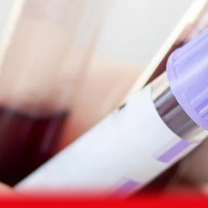 WHAT IS A BONE PROFILE BLOOD TEST?