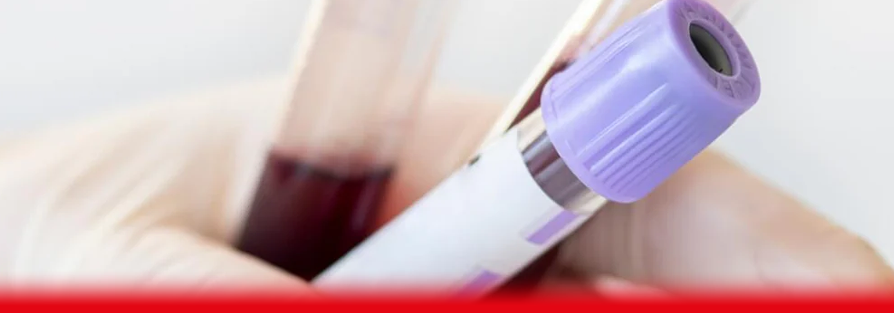 WHAT IS A BONE PROFILE BLOOD TEST?