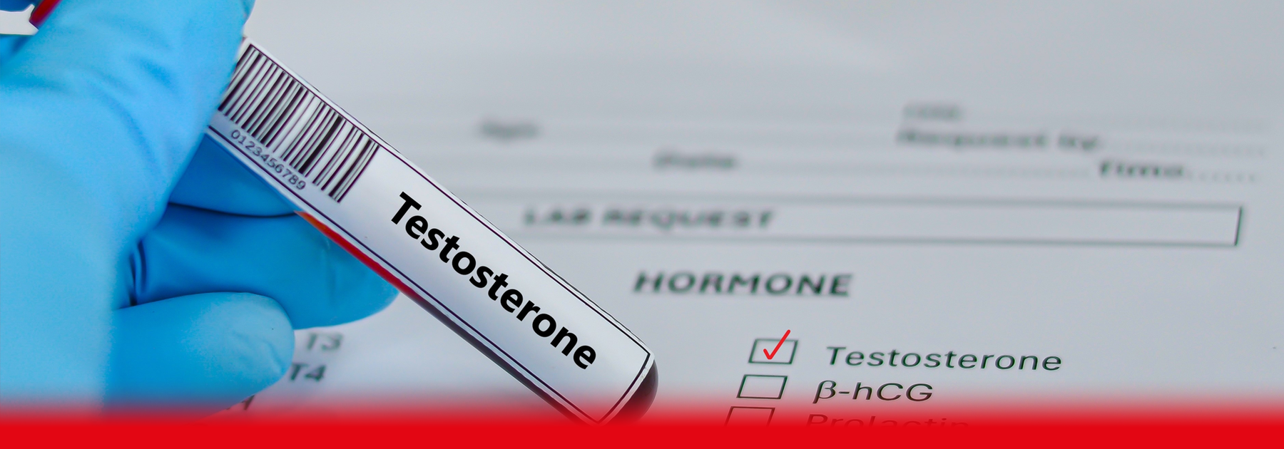 testosterone test blood testing tube