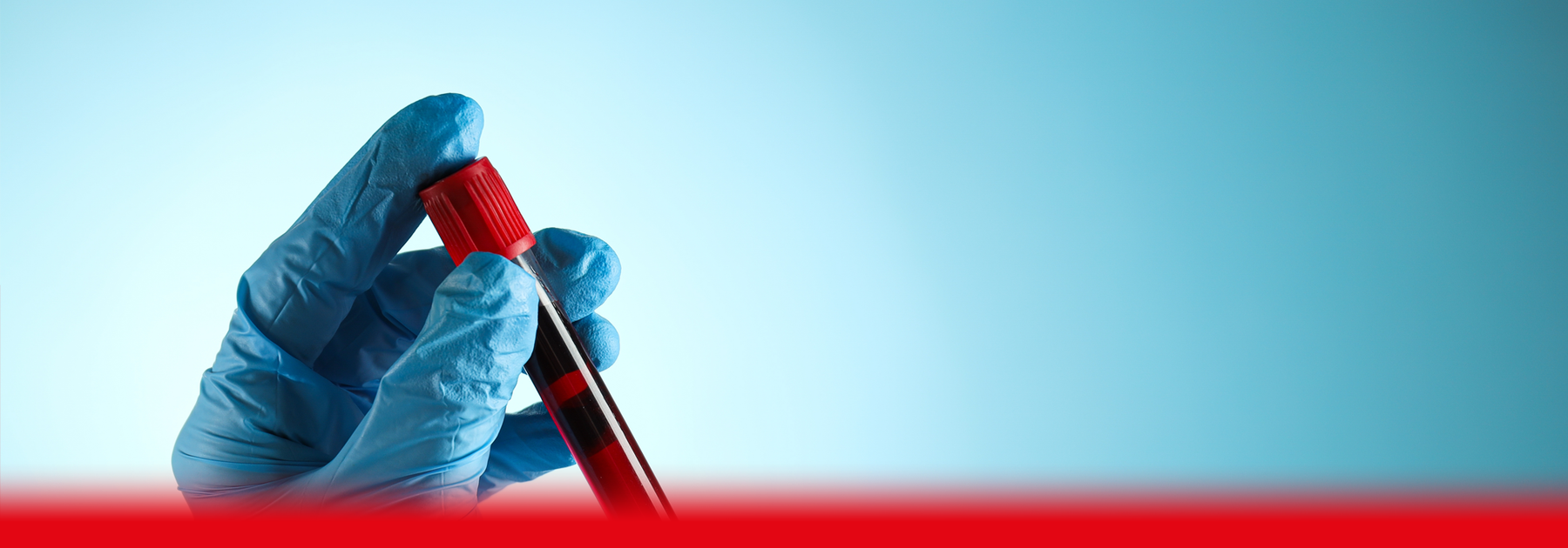 CAN I ASK MY GP FOR A HORMONE BLOOD TEST?