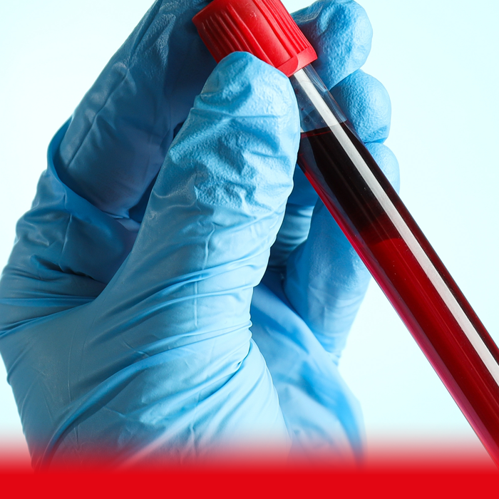 doctor holding blood sample