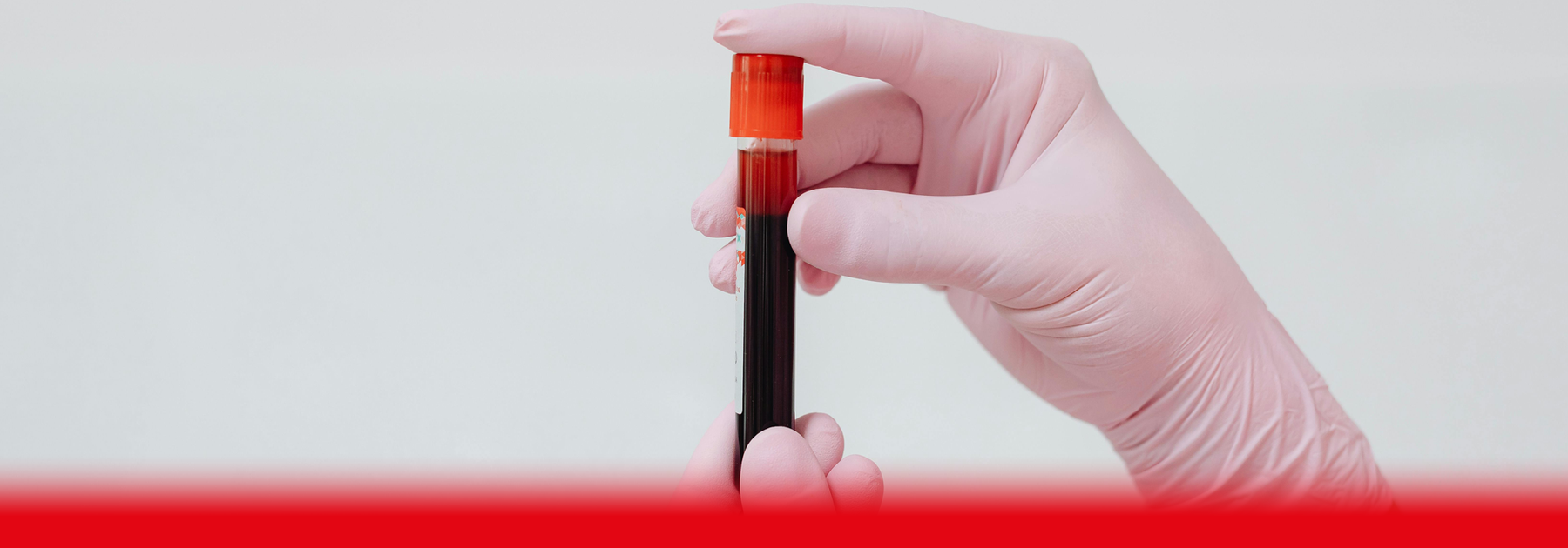 doctor holding blood sample