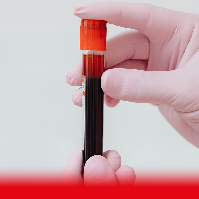 doctor holding blood sample