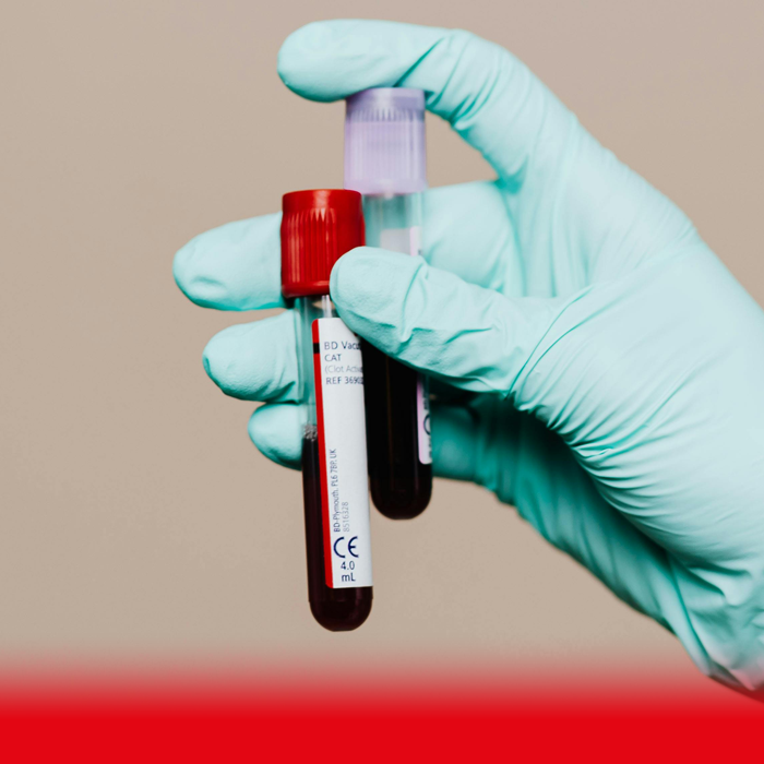 doctor holding blood sample