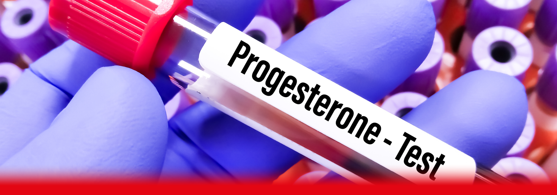 doctor holding tube labelled progesterone