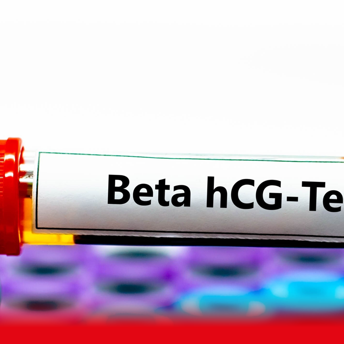 WHY DO DOCTORS SUGGEST BETA HCG TESTS?