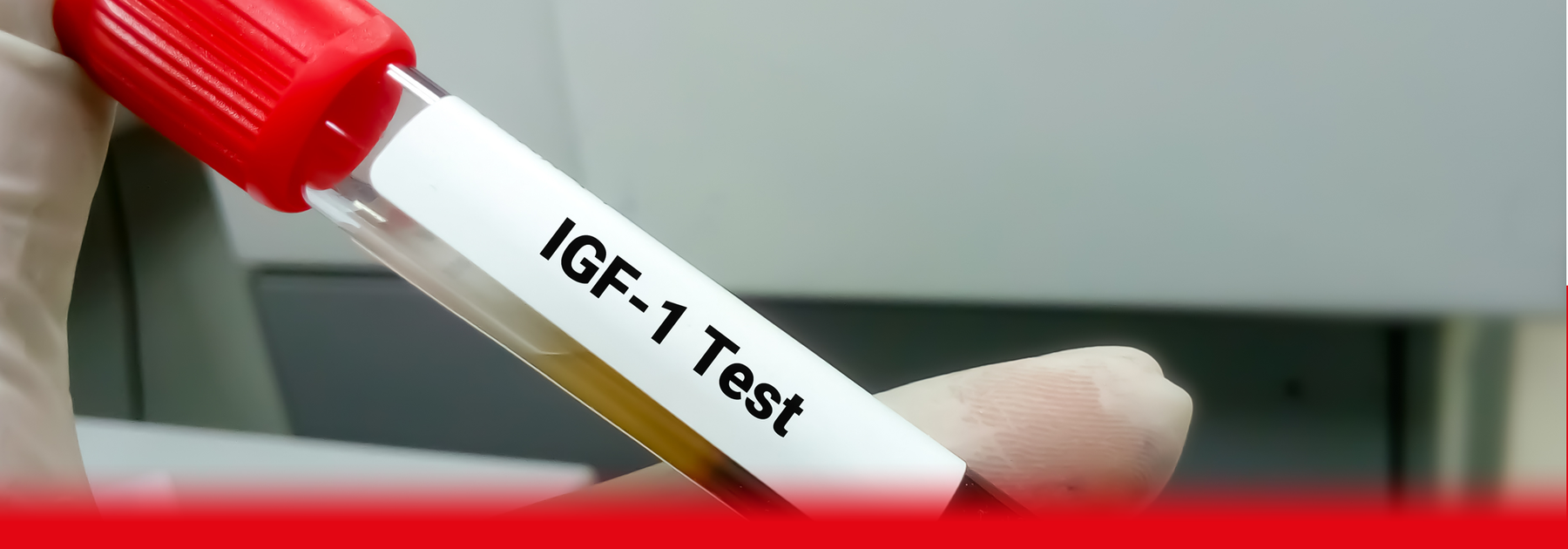 igf-1 blood test sample