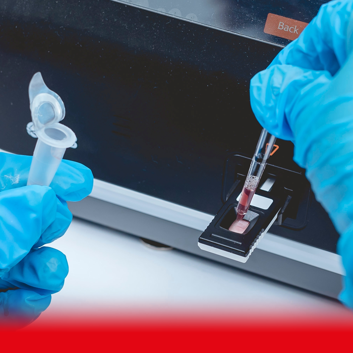 doctor taking blood sample