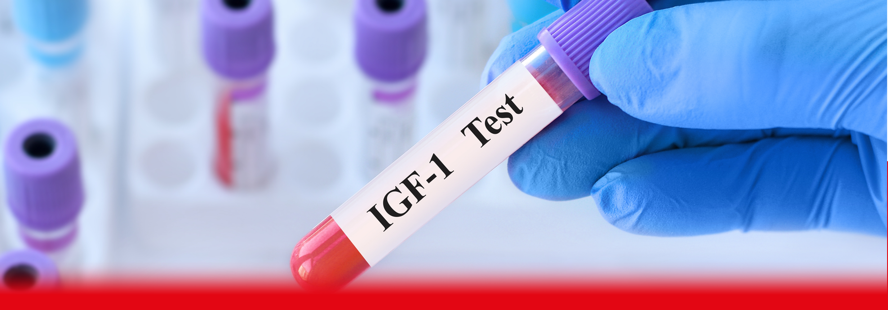 igf1 blood test sample