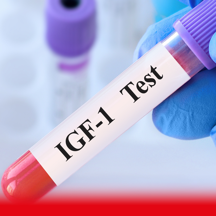 igf1 blood test sample