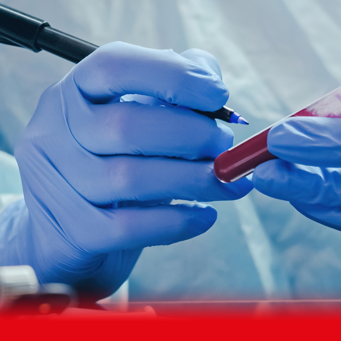 doctor labelling blood sample