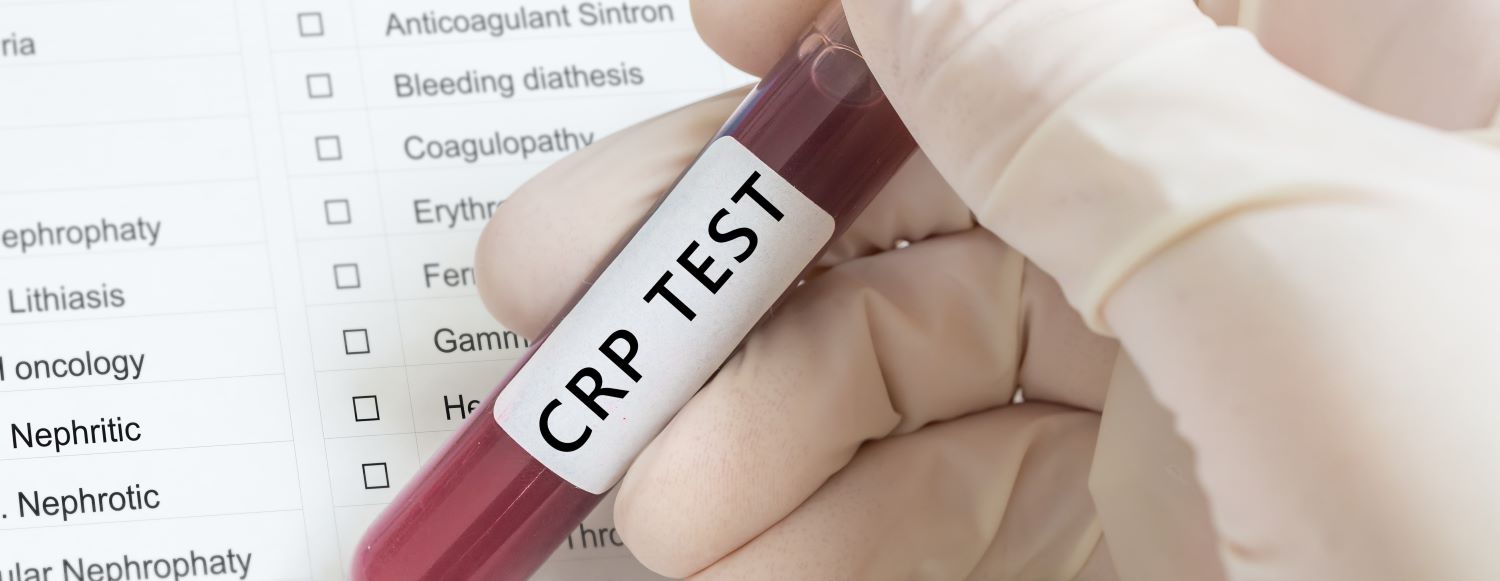 CRP Blood test