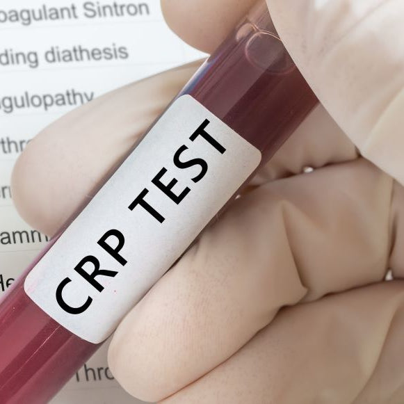 CRP Blood test