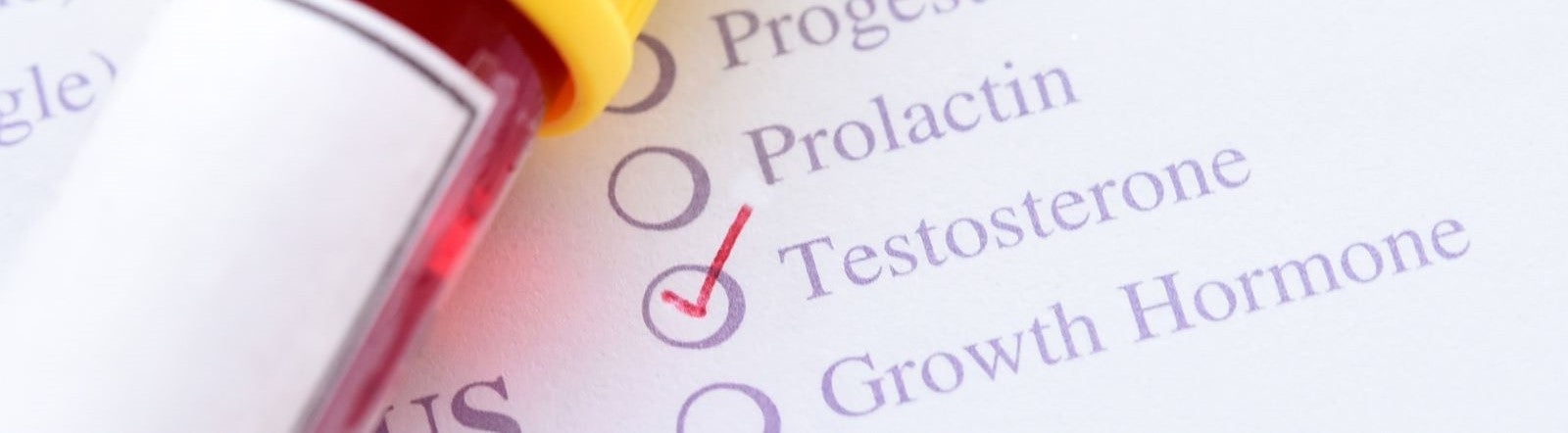Testosterone blood test