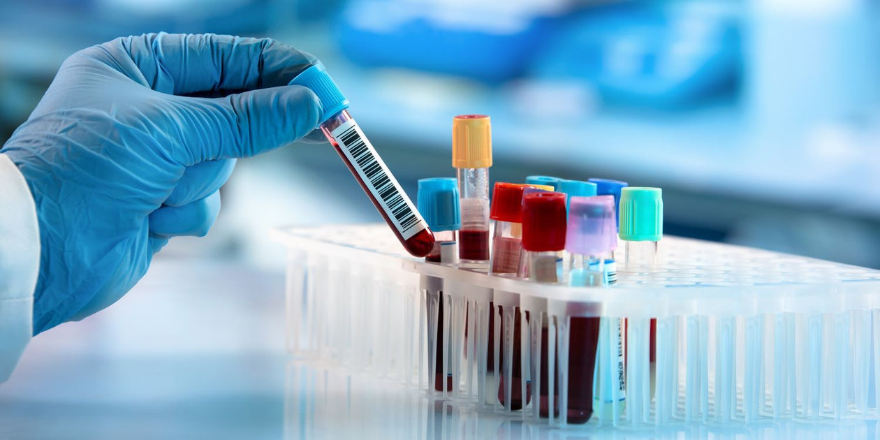 Understanding Haematocrit (HCT) and Its Role in a Full Blood Count Test ...