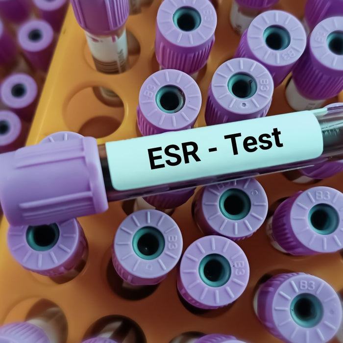 ESR blood test