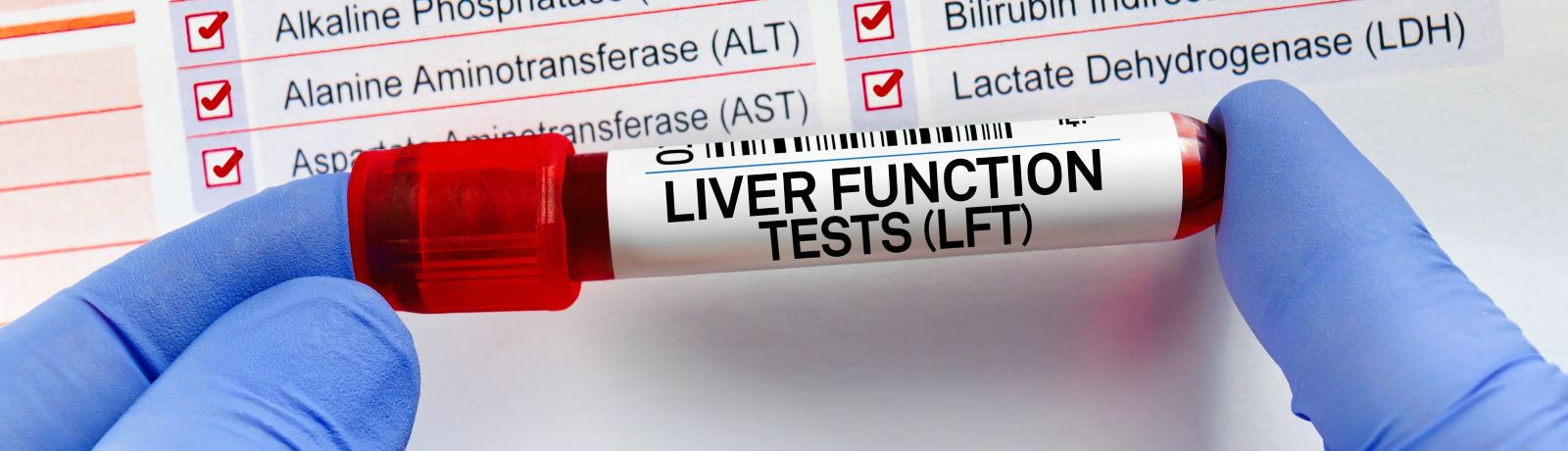 Liver function blood test