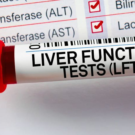 Liver function blood test