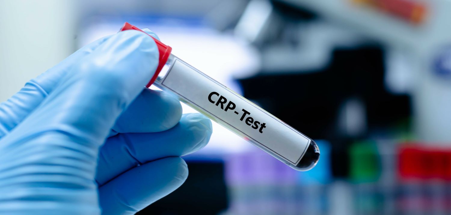 CRP Blood test