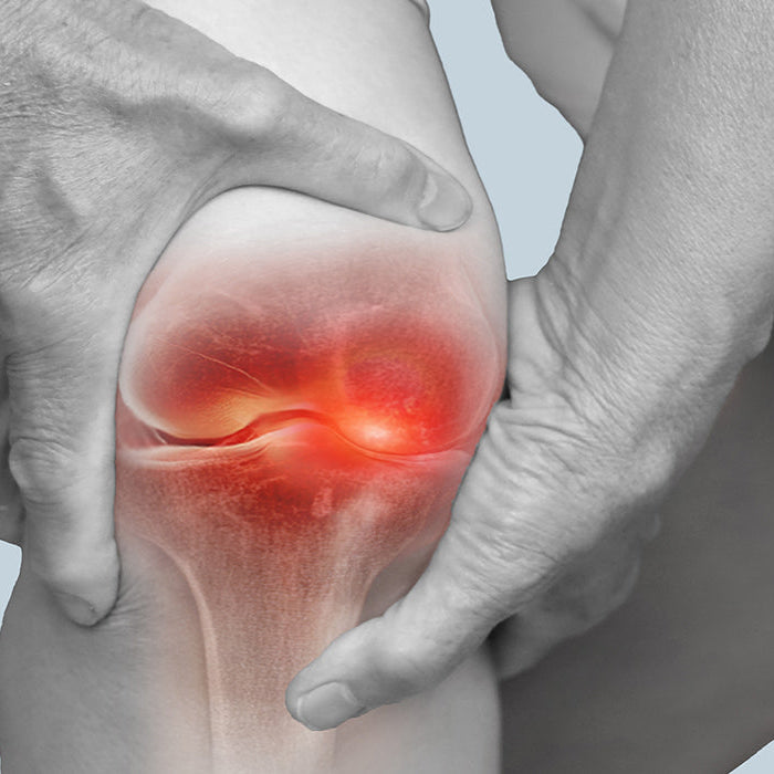 Arthritis in the knee