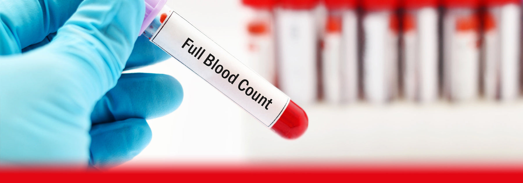 full blood count test