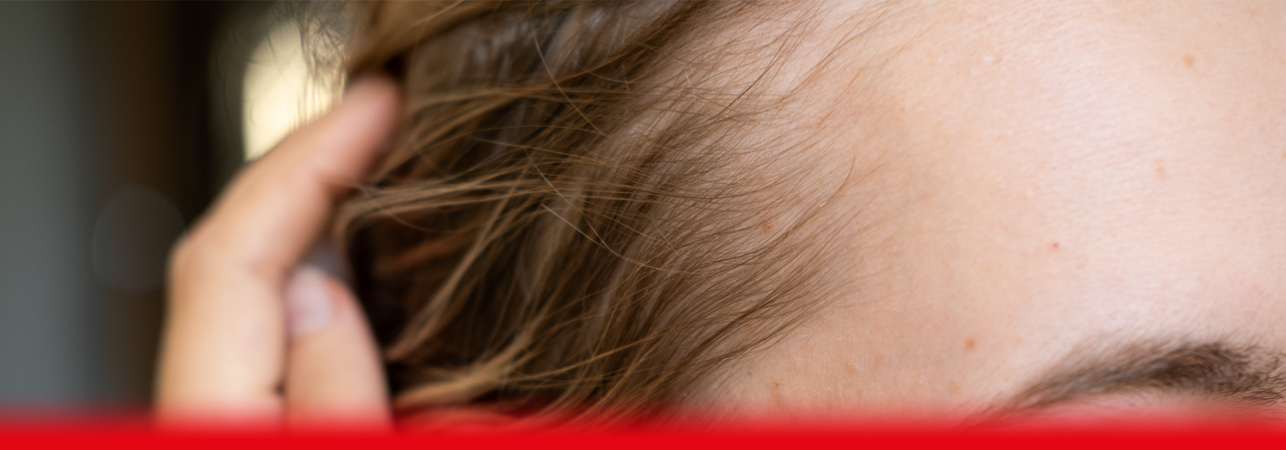 woman with hair loss