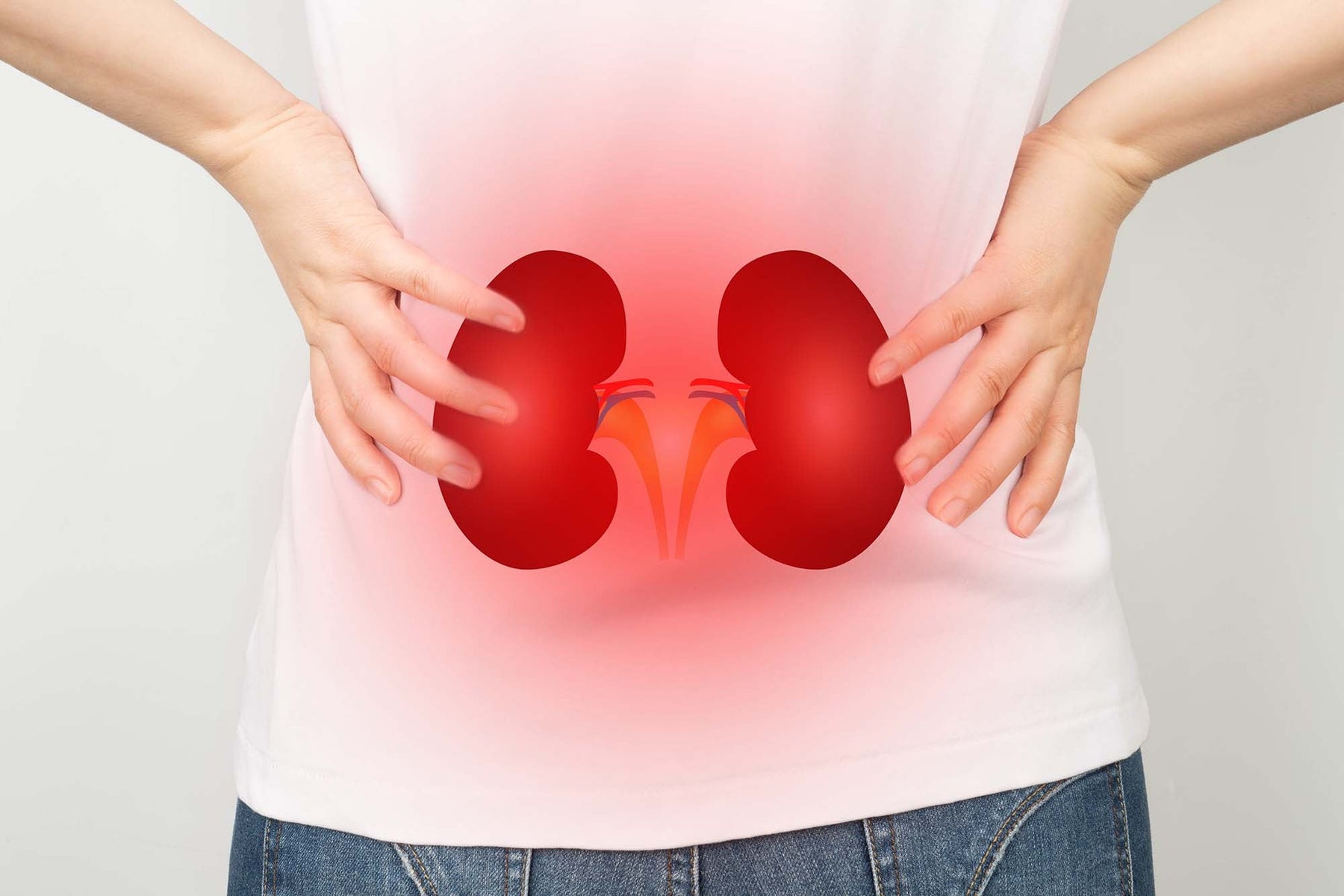 Chronic kidney disease image with location of kidneys