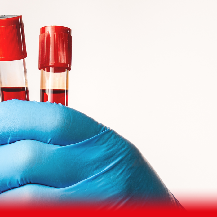 blood test