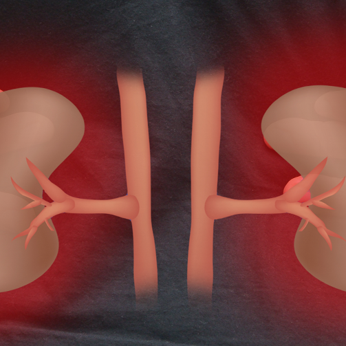 kidney pain