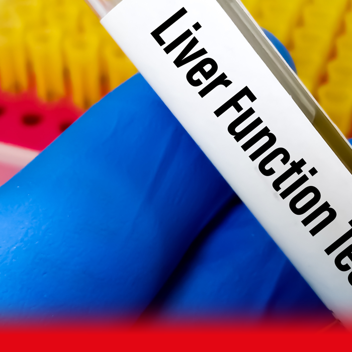 doctor holding liver function test sample