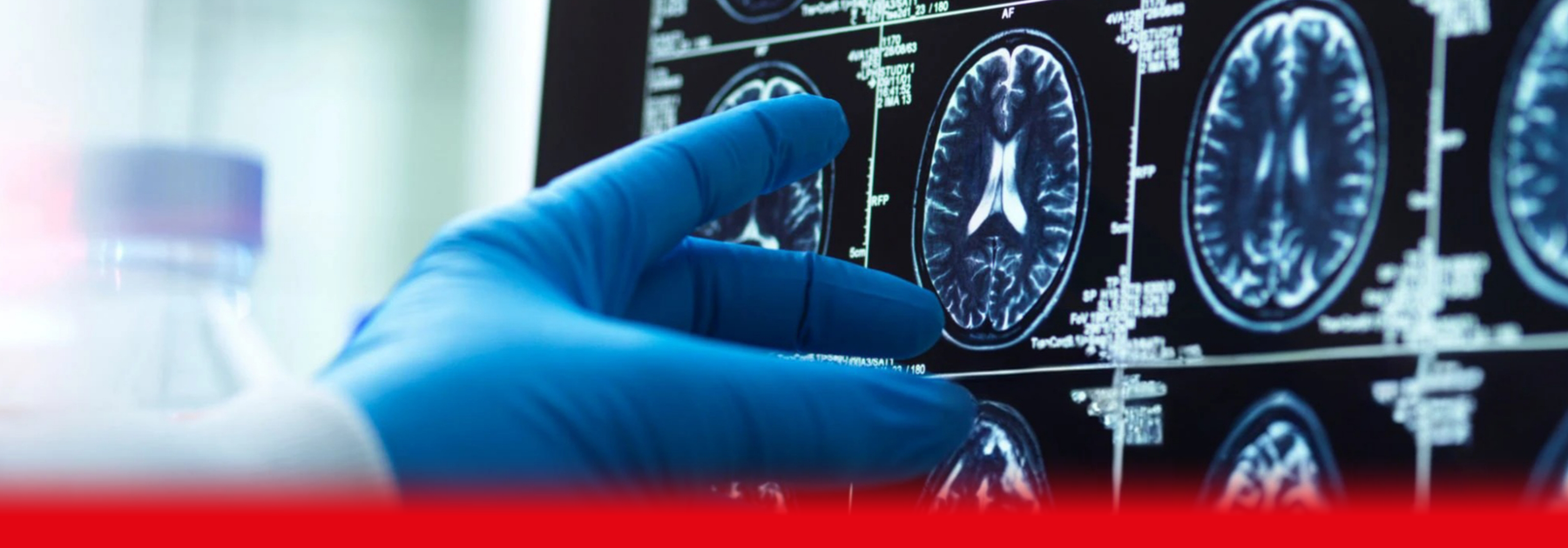 brain scan