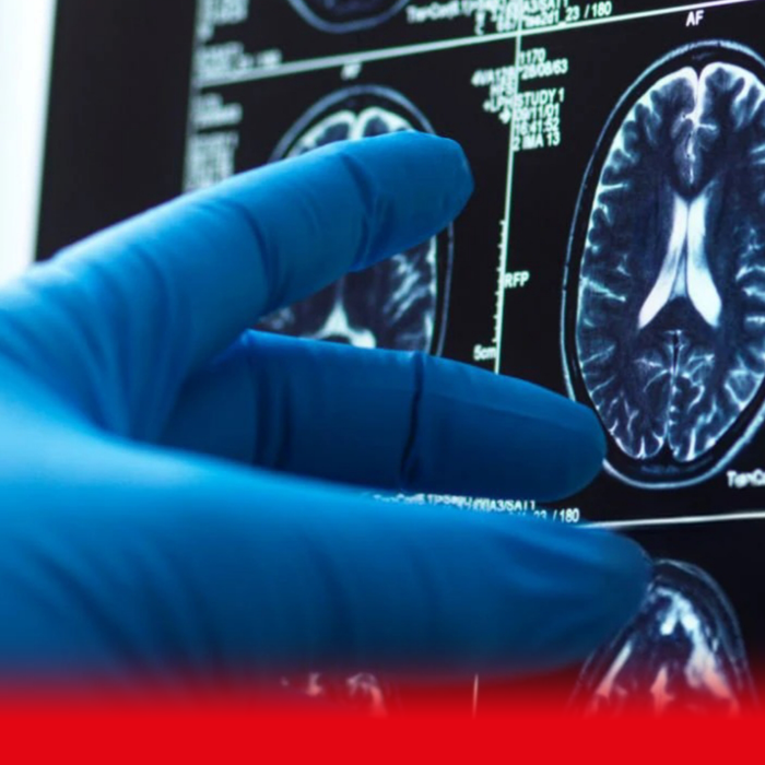 brain scan