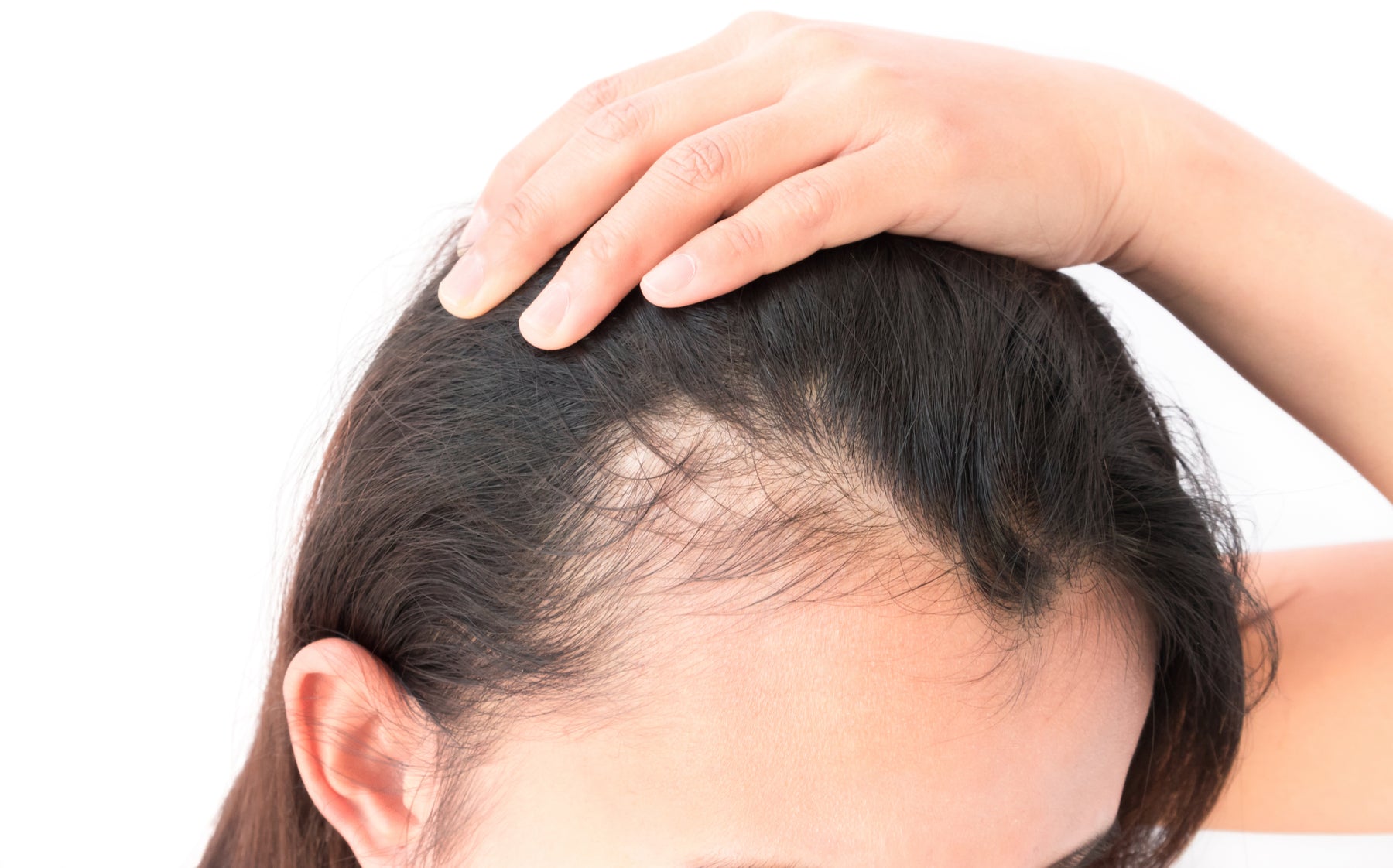 Dr Mike Forsythe on Hair Loss and Its Causes